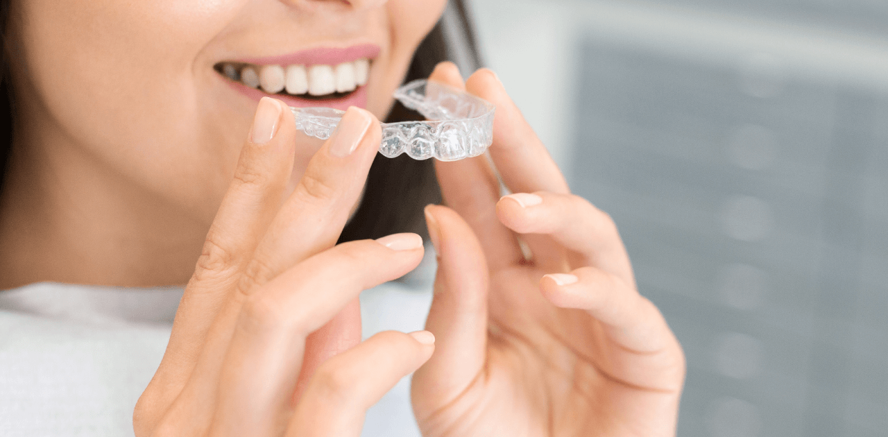 יישור שיניים מהיר דוגמא לקשתיות שקופות 