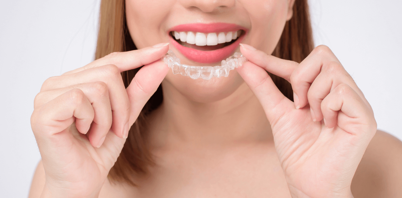 יישור שיניים ללא גשר כל מה שצריך לדעת
